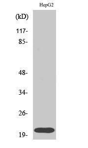 Western blot analysis of various cells using Anti-RhoA Antibody