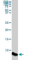 Anti-ATOX1 Mouse Monoclonal Antibody [clone: 4D6]