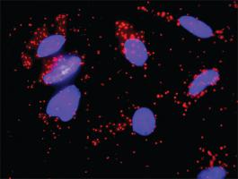 Anti-FGF8 Mouse Monoclonal Antibody [clone: 2A11]