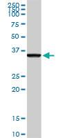 Anti-PDX1 Rabbit Polyclonal Antibody