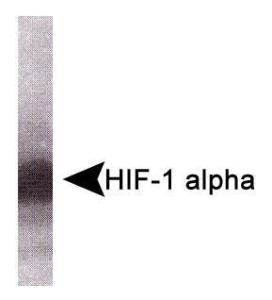 Anti-HIF1A Mouse Monoclonal Antibody [clone: HA111]