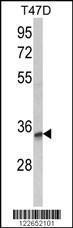 Anti-TSPAN12 Rabbit Polyclonal Antibody (HRP (Horseradish Peroxidase))