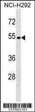 Anti-ATP6V1C2 Rabbit Polyclonal Antibody (Biotin)