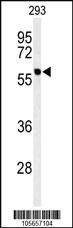 Anti-PPM1G Rabbit Polyclonal Antibody