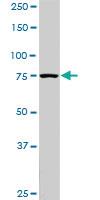 Anti-PIK3R1 Mouse Monoclonal Antibody [clone: 3C11]