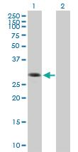 Anti-GEMIN2 Mouse Polyclonal Antibody