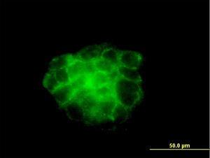 Anti-KRT4 Mouse Monoclonal Antibody [clone: 5H5]