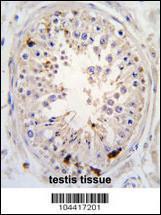 Anti-USP2 Rabbit Polyclonal Antibody (APC (Allophycocyanin))