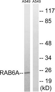 Western blot analysis of lysates from A549 cells using Anti-RAB6A Antibody. The right hand lane represents a negative control, where the antibody is blocked by the immunising peptide