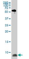 Anti-ATOX1 Mouse Monoclonal Antibody [clone: 4D6]