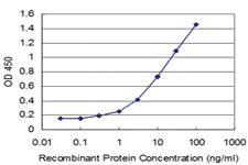 Anti-FGF8 Mouse Monoclonal Antibody [clone: 2A11]