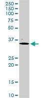 Anti-PDX1 Rabbit Polyclonal Antibody