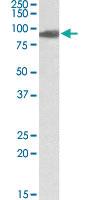 Anti-ACO2 Goat Polyclonal Antibody