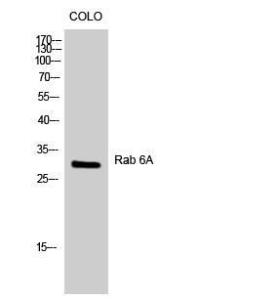 Western blot analysis of COLO cells using Anti-RAB6A Antibody