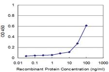 Anti-PIK3R1 Mouse Monoclonal Antibody [clone: 3C11]