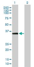 Anti-AKTIP Mouse Polyclonal Antibody