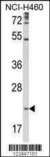 Anti-TSPAN31 Rabbit Polyclonal Antibody (AP (Alkaline Phosphatase))