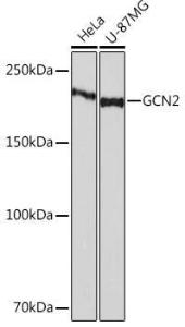 Western blot analysis of extracts of various cell lines, using Anti-GCN2 Antibody [ARC52336] (A306894) at 1:1,000 dilution The secondary antibody was Goat Anti-Rabbit IgG H&L Antibody (HRP) at 1:10,000 dilution Lysates/proteins were present at 25 µg per lane