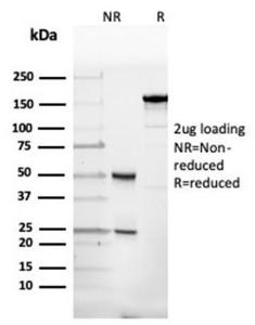 SDS-PAGE analysis of Anti-alpha II Spectrin Antibody [SPTAN1/3507] under non-reduced and reduced conditions; showing intact IgG and intact heavy and light chains, respectively. SDS-PAGE analysis confirms the integrity and purity of the antibody