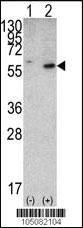 Anti-PTEN Rabbit Polyclonal Antibody