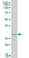 Anti-FGF8 Mouse Monoclonal Antibody [clone: 3H2]