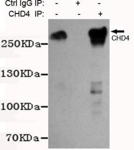 Anti-CHD4 Mouse Monoclonal Antibody [clone: 13k32]