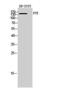 Antibody anti-PNPLA6 100 µg