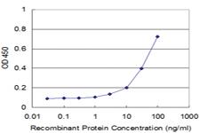 Anti-PI4KB Mouse Monoclonal Antibody [clone: 3B1]