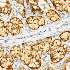 Immunohistochemistry analysis of paraffin-embedded rat intestine using Anti-GCN2 Antibody [ARC52336] (A306894) at a dilution of 1:500 (40x lens) Perform high pressure antigen retrieval with 10 mM citrate buffer pH 60 before commencing with IHC staining protocol