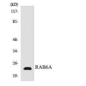 Western blot analysis of the lysates from HT 29 cells using Anti-RAB6A Antibody