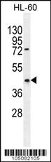 Anti-PTEN Rabbit Polyclonal Antibody