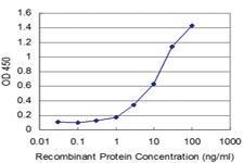 Anti-FGF8 Mouse Monoclonal Antibody [clone: 3H2]