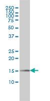 Anti-PIN1 Mouse Monoclonal Antibody [clone: 2F2]