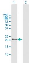 Anti-RGS5 Rabbit Polyclonal Antibody