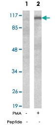 Anti-PTK2B Rabbit Polyclonal Antibody