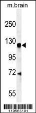 Anti-AGAP2 Rabbit Polyclonal Antibody (AP (Alkaline Phosphatase))