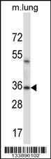 Anti-ERCC1 Rabbit Polyclonal Antibody