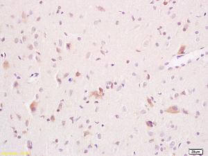 Anti-ARSA Rabbit Polyclonal Antibody