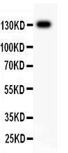 Anti-ITGB1/Integrin Beta 1 Polyclonal Antibody