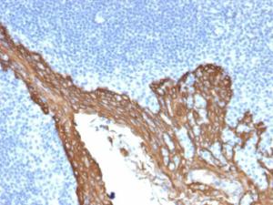 Immunohistochemical analysis of formalin-fixed, paraffin-embedded human prostate using Anti-Cytokeratin 8 Antibody [KRT8/2115]