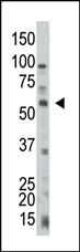 Anti-PTEN Rabbit Polyclonal Antibody