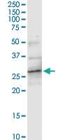 Anti-ATP6V1E2 Polyclonal Antibody Pair