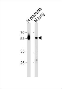 Anti-CREB3L2 Rabbit Polyclonal Antibody