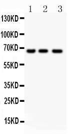 Anti-NF-kB p65 Polyclonal Antibody