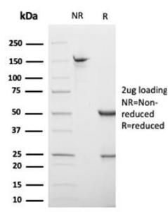 SDS-PAGE analysis of Anti-S100 beta Antibody [S100B/4138] under non-reduced and reduced conditions; showing intact IgG and intact heavy and light chains, respectively. SDS-PAGE analysis confirms the integrity and purity of the antibody.