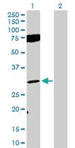 Anti-FGF12 Rabbit Polyclonal Antibody