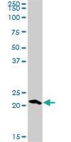 Anti-RGS5 Rabbit Polyclonal Antibody