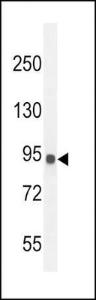 Anti-IL12RB2 Rabbit Polyclonal Antibody (AP (Alkaline Phosphatase))