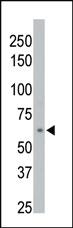 Anti-PPM1D Rabbit Polyclonal Antibody