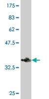 Anti-HIP1R Mouse Monoclonal Antibody [clone: 3E10]